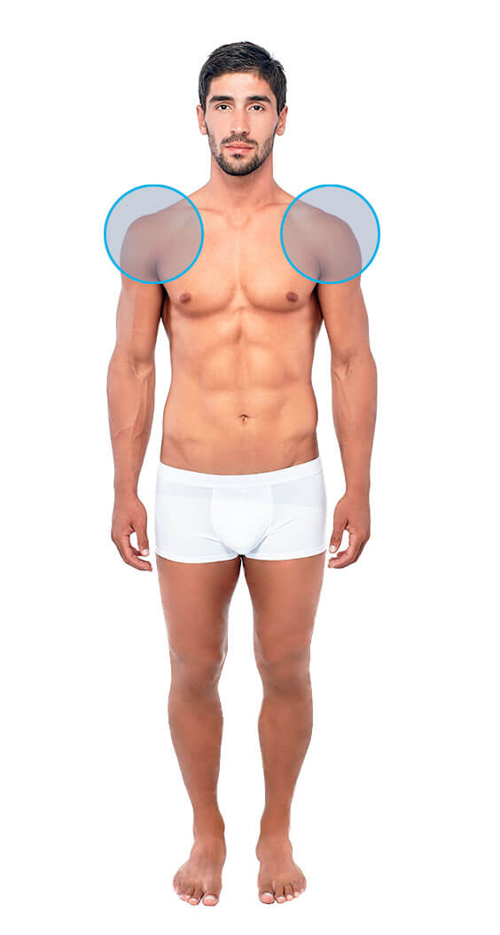 Modelo masculino con dos círculos señalando la zona de depilación láser masculina de hombros